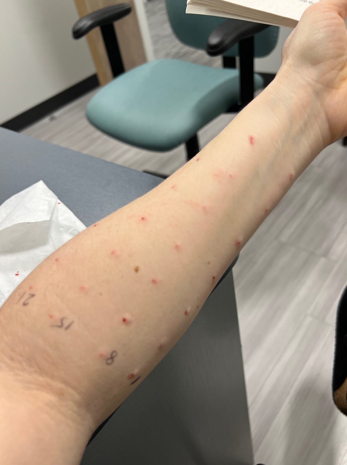 Endometriosis and Dust: Why I Clean Wearing an N95 Mask | Fairfield ...